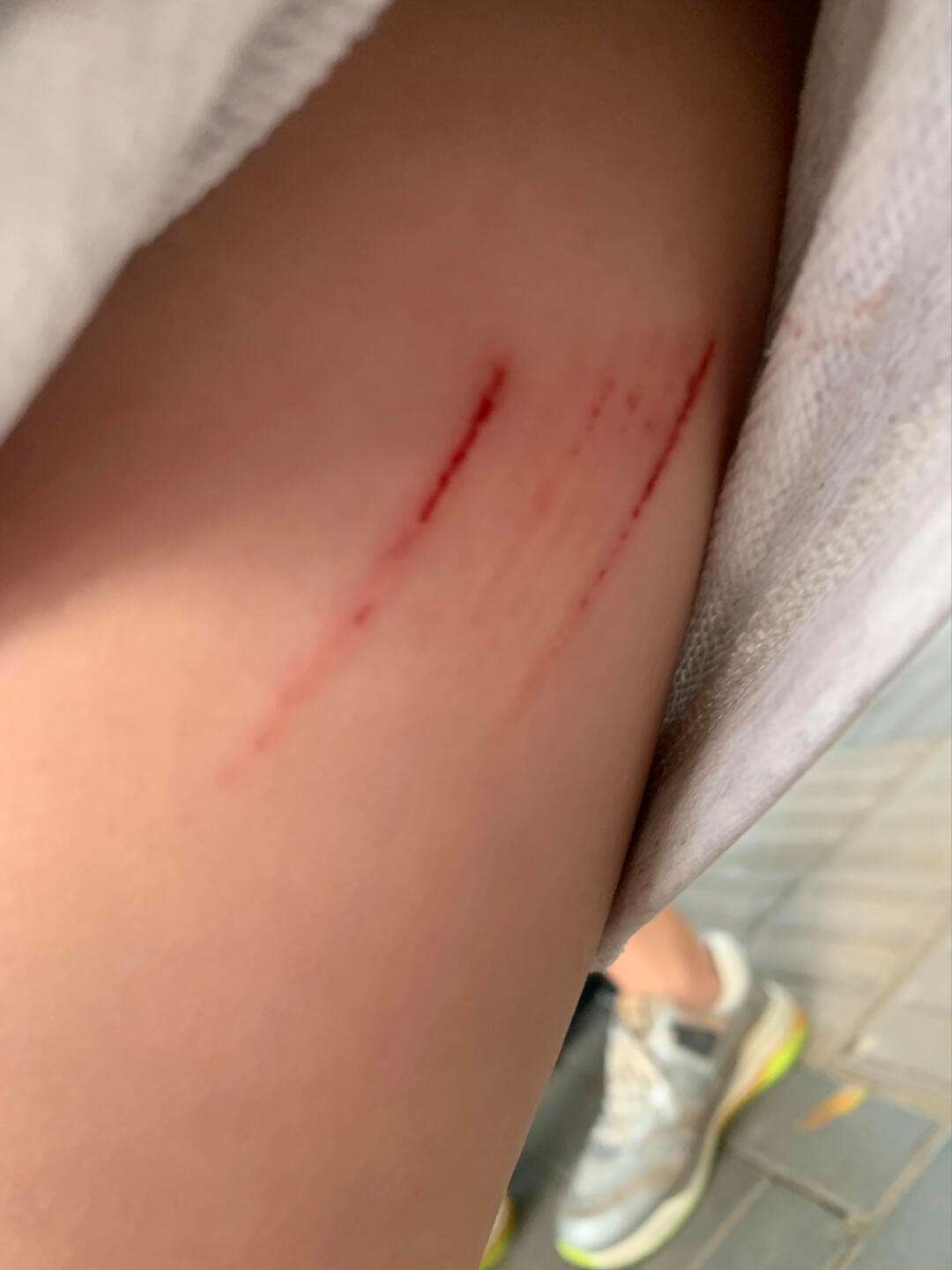 瓦伦西亚传奇:球星大腿受伤的简单介绍 瓦伦西亚传奇:球星大腿受伤的简单介绍